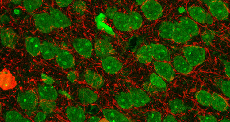 Image of interneurons (red) and nuclei (green) in mouse cerebral cortex. Image acquired by Deanna Benson on a Zeiss LSM 780